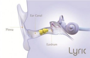 Lyric ear diagram