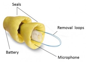 Lyric close-up, seals, battery